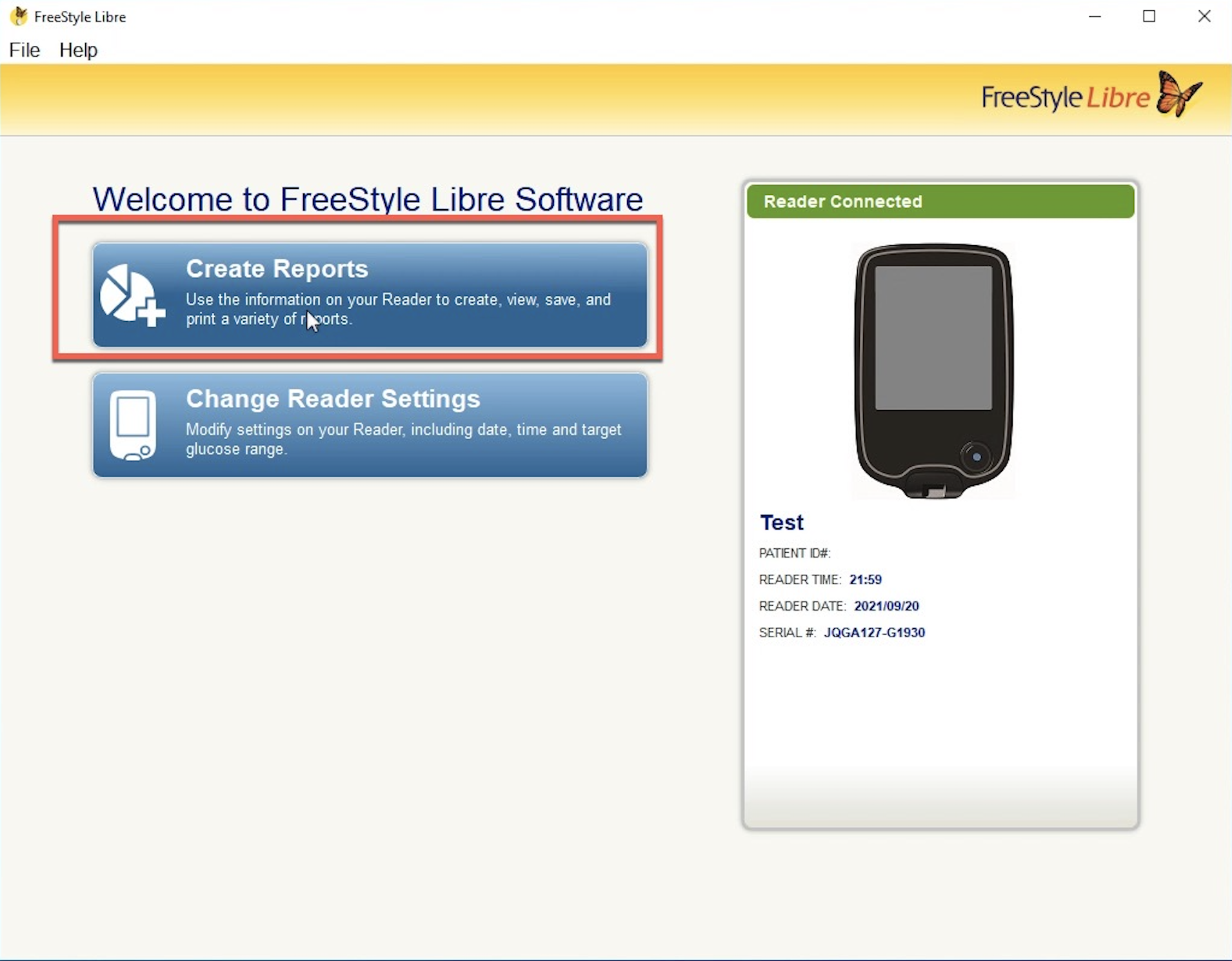 How To Import Data From An Abbott Freestyle Libre CGM Device RocheDiabetes Care Platform Support